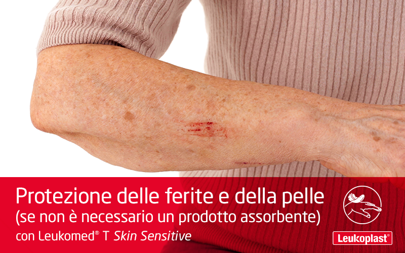 Questo video mostra come una medicazione in pellicola trasparente è utilizzata sulla pelle fragile: vediamo operatore applicare Leukomed T Skin Sensitive su un graffio sull'avambraccio di una signora anziana. Questo video mostra come una medicazione in pellicola trasparente è utilizzata sulla pelle fragile: vediamo operatore applicare Leukomed T Skin Sensitive su un graffio sull'avambraccio di una signora anziana.
